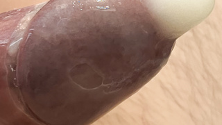 Mein steifer Vitiligo Penis.