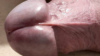 Mein steifer Vitiligo Penis.