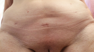 Was ist schöner , Nicole mit oder ohne Haare ?