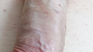 Penis Vorstellungsrunde
