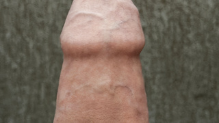 Beringter Penis