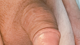 Kleiner Penis erste Bilder