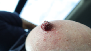 Oma Sigrids einzigarte Nippel