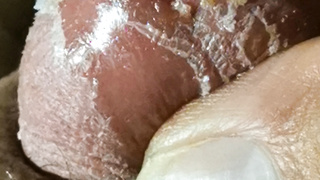 Jörgzeigt seinen Minipenis