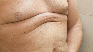 Nackt in Bernau Sommer ist so schön