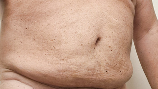 Nackt in Bernau Sommer ist so schön