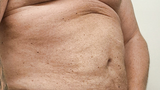 Nackt in Bernau Sommer ist so schön