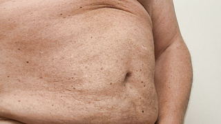 Nackt in Bernau Sommer ist so schön