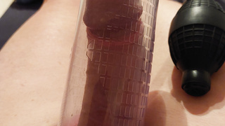 "Er" in voller Pracht