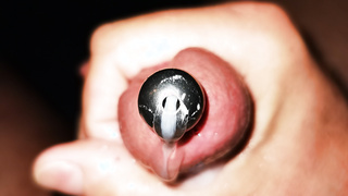 Dilator, wo das Sperma sprudeln kann