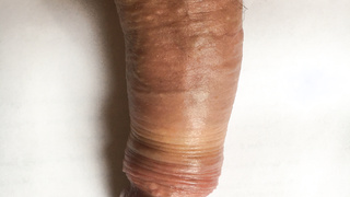 Mein kleiner halbsteifer Freund