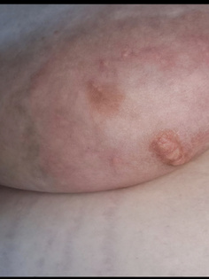 Brustwarzen meiner Maus