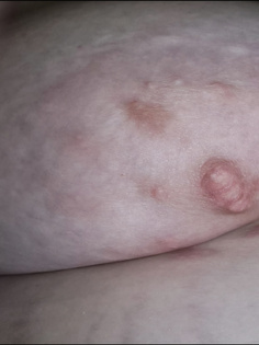 Mollige Nippel