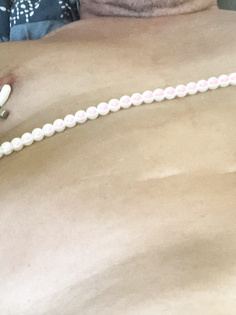 Nippelklemmen