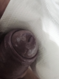 Peehole dehnen zum Orgasmus