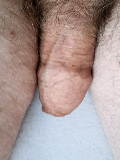 Mein Penis am Morgen....