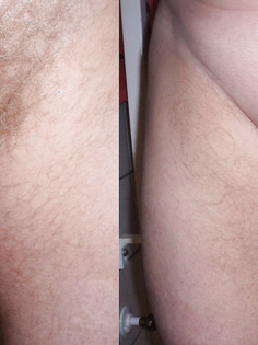 Mein Penis mit und ohne Haar
