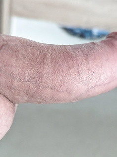 Fotosession mit Cockring