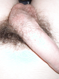 Haariger Vorhautpenis