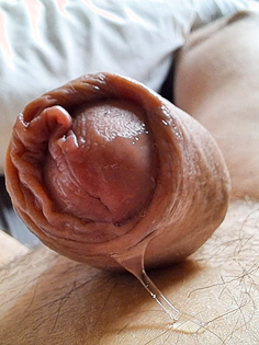 Feucht aufwachen in der Ferienhütte