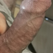Wixxer1