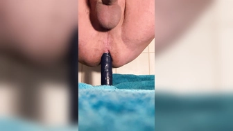 Analstimulation
