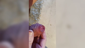 Vorhaut langsam zurückgezogen.