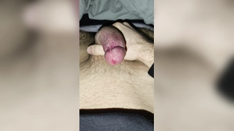 Penis Vorstellung