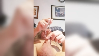 Dilator Schwanz einführen