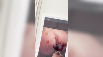 Bilder Besamen für Amoruso