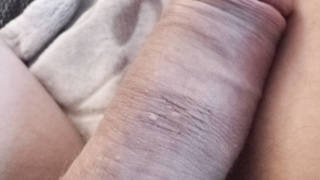 Penis in unterschiedlicher Form