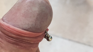 Schwanz mit Dilatation