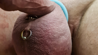 Sack mit Kochsalzlösung gepimt