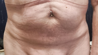 Neue Bilder in Gummi