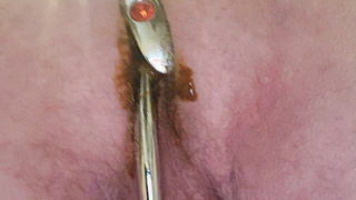 Analhaken mit Dillator